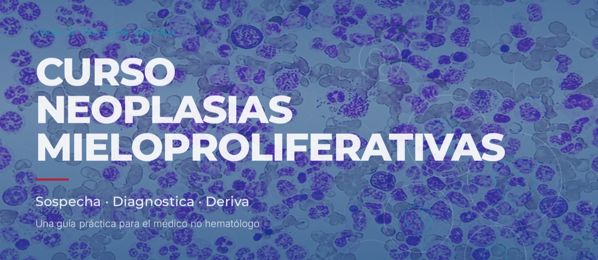 Imagen de referencia - CURSO E-LEARNING:
Neoplasias Mieloproliferativas