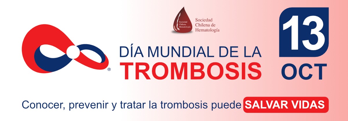 Imagen de referencia - 13 de octubre | Día Mundial de la Trombosis
